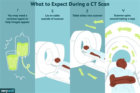 CT Scan (CAT Scan): Purpose, Procedure, Risks, Side .
